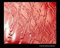 listeria monocytogenes